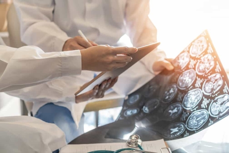 Doctors go over a brain scan